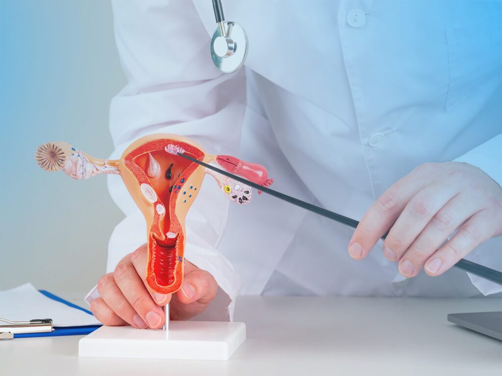 KARCINOM-GRLICA-MATERICE-CSM-Beograd-1